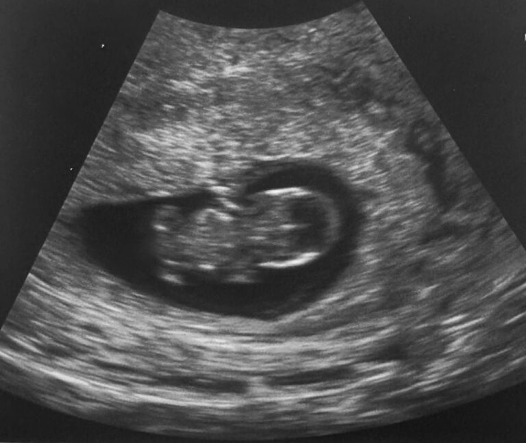Before I meet my son